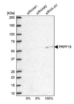 PRP19 Antibody, Novus Biologicals:Antibodies:Primary Antibodies